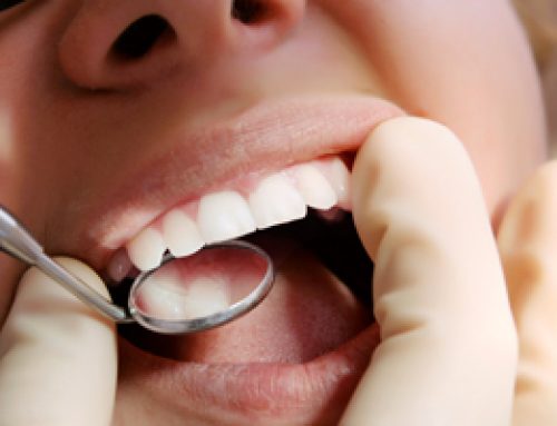 Oral Exams: Open Your Mouth and Say Ahhh