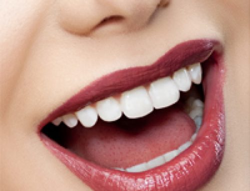 Tooth Colored Fillings: Now You See ’em…
