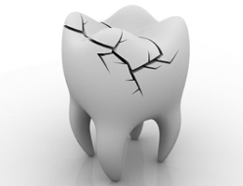 Learning More About Cracked Teeth