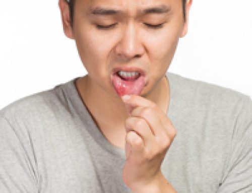Fever Blisters, Cold Sores, Canker Sores
