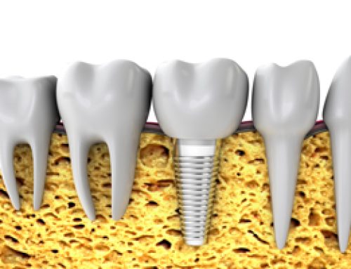 When Prescriptions and Dentistry Don’t Mix